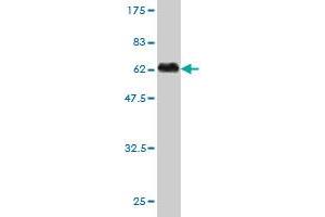 Western Blot detection against Immunogen (56. (SLA antibody  (AA 1-276))