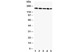 Western blot testing of GLI2 antibody and Lane 1: MCF-7 (GLI2 antibody  (C-Term))