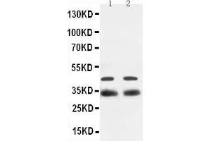 Western Blotting (WB) image for anti-SRY (Sex Determining Region Y)-Box 2 (SOX2) (AA 171-183), (Middle Region) antibody (ABIN3044477)
