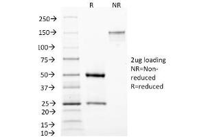 SDS-PAGE Analysis Purified MAML3 Monoclonal Antibody (MAML3/1303).