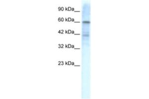 Western Blotting (WB) image for anti-Potassium Voltage-Gated Channel, Shal-Related Subfamily, Member 3 (KCND3) antibody (ABIN2461109) (KCND3 antibody)