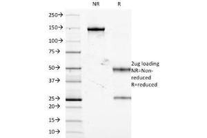 SDS-PAGE Analysis of Purified, BSA-Free TNF-alpha Antibody (clone J2D10). (TNF alpha antibody)