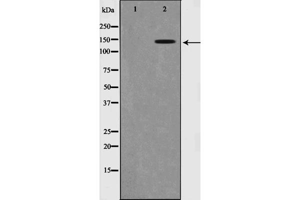 TRKB antibody  (pTyr516)