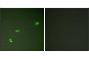 Immunofluorescence analysis of HeLa cells treated with EGF 200nM 5', using NPM (Phospho-Thr199) Antibody. (NPM1 antibody  (pThr199))
