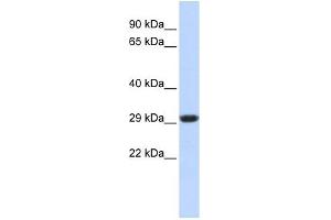 SDHB antibody used at 1 ug/ml to detect target protein. (SDHB antibody)