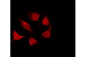 Immunofluorescence (fixed cells) (IF/ICC) image for anti-Checkpoint Kinase 1 (CHEK1) (pSer317) antibody (ABIN6255201)