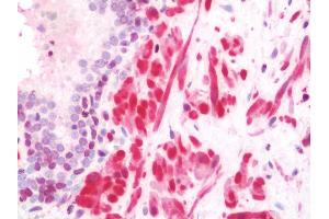 Anti-TAGLN / Transgelin / SM22 antibody IHC staining of human prostate. (Transgelin antibody  (FITC))