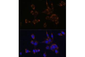 Immunofluorescence (IF) image for anti-Perforin 1 (Pore Forming Protein) (PRF1) (AA 280-555) antibody (ABIN3020642)