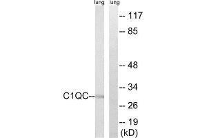 Western Blotting (WB) image for anti-Complement Component 1, Q Subcomponent, C Chain (C1QC) (Internal Region) antibody (ABIN1851148) (C1QC antibody  (Internal Region))