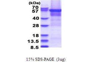 SDS-PAGE (SDS) image for Cytoplasmic Polyadenylation Element Binding Protein 1 (CPEB1) (AA 1-561) protein (His tag) (ABIN5853676)