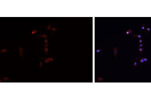 ABIN6276729 staining HEPG2 cells by IF/ICC. (Tryptophan Hydroxylase 1 antibody  (Internal Region))