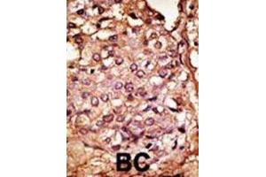 Immunohistochemistry (IHC) image for anti-Chemokine Binding Protein 2 (CCBP2) antibody (ABIN3001323) (CCBP2 antibody)