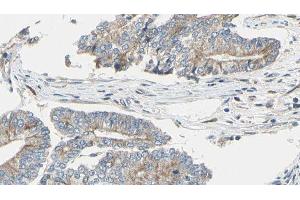 ABIN6275020 at 1/100 staining Human prostate tissue by IHC-P. (CLASP1 antibody  (Internal Region))