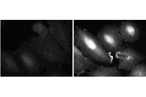 Immunofluorescent staining of A549 (ATCC CCL-185) cells. (ERK1/2 antibody  (pThr202))