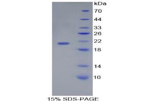 SDS-PAGE analysis of Human Interleukin 17C Protein.