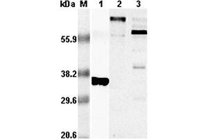 Western blot analysis using anti-RANKL (human), pAb  at 1:5,000 dilution. (RANKL antibody)