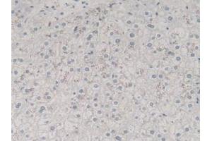 Figure. (TGFB3 antibody  (AA 24-300))