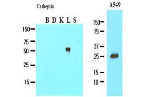 Western Blotting (WB) image for anti-Cathepsin L1 (CTSL1) (AA 114-333) antibody (ABIN317508) (Cathepsin L antibody  (AA 114-333))