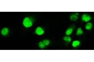 Image no. 12 for anti-Myc Proto-Oncogene protein (MYC) antibody (ABIN1497012) (c-MYC antibody)