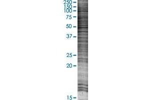 BNIP3 transfected lysate. (BNIP3 293T Cell Transient Overexpression Lysate(Denatured))