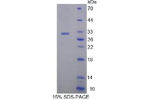 Image no. 1 for BMX Non-Receptor Tyrosine Kinase (BMX) (AA 209-446) protein (His tag) (ABIN4991065)