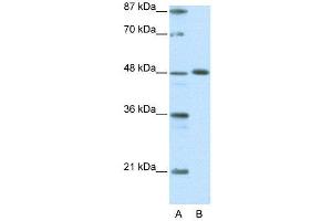 WB Suggested Anti-ZNF259  Antibody Titration: 0. (ZNF259 antibody  (C-Term))