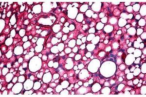 Immunohistochemistry (Formalin-fixed Paraffin-embedded Sections) (IHC (fp)) image for anti-Apolipoprotein A-I (APOA1) antibody (ABIN625900)