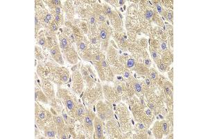 Immunohistochemistry of paraffin-embedded human liver injury using TXNL1 antibody (ABIN5973739) at dilution of 1/100 (40x lens). (TXNL1 antibody)