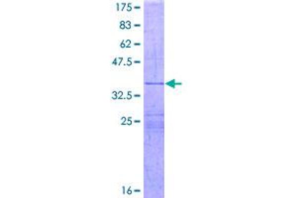 IL-26 Protein (AA 74-171) (GST tag)