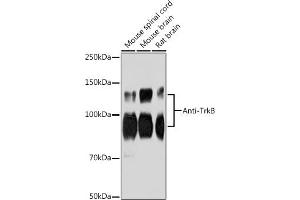 Western blot analysis of extracts of various cell lines, using Anti-TrkB antibody (ABIN7268896) at 1:1000 dilution. (TRKB antibody)