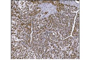 IHC analysis of LRP1B using anti-LRP1B antibody (ABIN7601521). (LRP1B antibody  (AA 3704-4547))