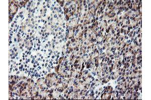 Immunohistochemistry (IHC) image for anti-Platelet/endothelial Cell Adhesion Molecule (PECAM1) antibody (ABIN1497243) (CD31 antibody)