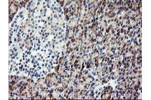 Immunohistochemistry (IHC) image for anti-Platelet/endothelial Cell Adhesion Molecule (PECAM1) antibody (ABIN1497243)