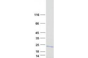 Validation with Western Blot (TIMM8B Protein (Transcript Variant 1) (Myc-DYKDDDDK Tag))