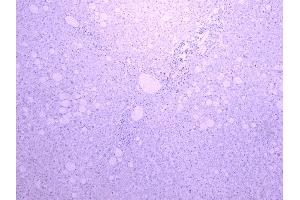 Immunohistochemistry (IHC) image for anti-Cytochrome P450, Family 3, Subfamily A, Polypeptide 4 (CYP3A4) (Internal Region) antibody (ABIN185606)
