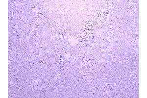 ABIN185606 Negative Control showing staining of paraffin embedded Human Liver, with no primary antibody. (CYP3A4 antibody  (Internal Region))