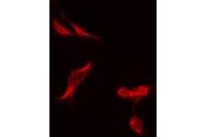 ABIN6275483 staining Hela by IF/ICC. (Renin antibody  (Internal Region))