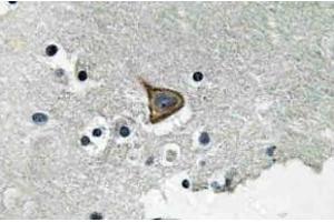 Immunohistochemistry (IHC) analyzes of p-Connexin 43 antibody in paraffin-embedded human brain tissue. (Connexin 43/GJA1 antibody  (pSer367))