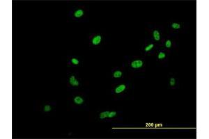 Immunofluorescence of purified MaxPab antibody to SAFB2 on HeLa cell. (SAFB2 antibody  (AA 1-528))