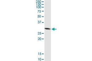 RBKS MaxPab rabbit polyclonal antibody. (Ribokinase antibody  (AA 1-322))