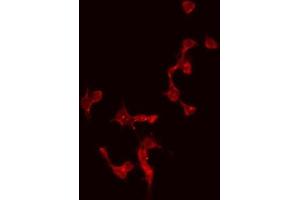 ABIN6274996 staining Hela by IF/ICC. (CBLN4 antibody  (Internal Region))
