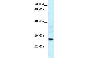 WB Suggested Anti-Snf8 Antibody   Titration: 1. (SNF8 antibody  (N-Term))