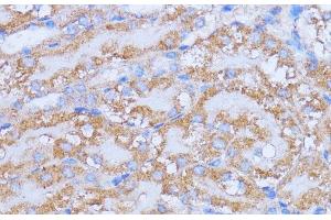 Immunohistochemistry of paraffin-embedded Mouse kidney using NME6 Polyclonal Antibody at dilution of 1:100 (40x lens).