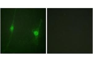 Immunofluorescence (IF) image for anti-serine/threonine Kinase 11 (STK11) (AA 384-433) antibody (ABIN2888735) (LKB1 antibody  (AA 384-433))