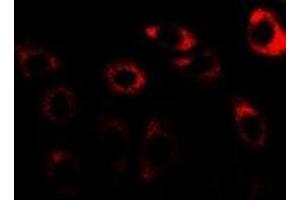 Immunofluorescent analysis of CCT3 staining in U2OS cells. (CCT3 antibody)