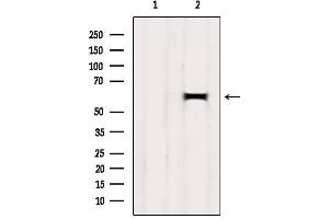 Western blot analysis of extracts from Mouse brain, using HEPACAM Antibody.