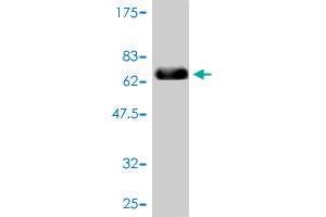 Western Blot detection against Immunogen (67. (TYR antibody  (AA 1-377))