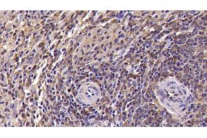 Detection of KLRD1 in Human Spleen Tissue using Monoclonal Antibody to Killer Cell Lectin Like Receptor Subfamily D, Member 1 (KLRD1) (CD94 antibody  (AA 32-179))