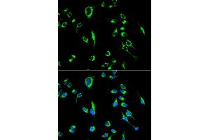 Immunofluorescence analysis of MCF7 cell using APOBEC3G antibody. (APOBEC3G antibody  (AA 60-330))