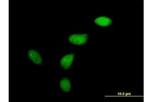 Immunofluorescence of purified MaxPab antibody to WEE1 on HeLa cell. (WEE1 antibody  (AA 1-646))